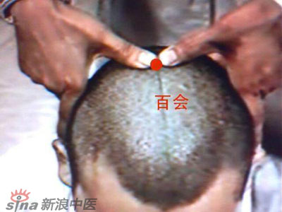 艾灸常用的保健穴有哪些？--百會(huì)